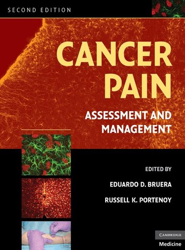 Eduardo D. Bruera, Russell K. Portenoy - Cancer Pain, Inbunden