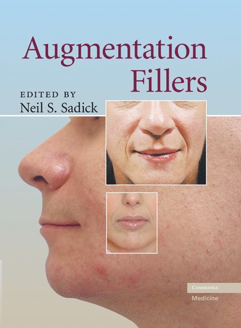 Augmentation Fillers 1