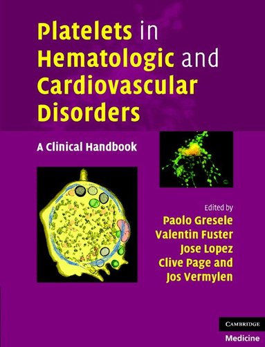 Paolo Gresele, Valentin Fuster, Jose A. Lopez, Clive P. Page, Jos Vermylen - Platelets in Hematologic and Cardiovascular Disorders, Inbunden