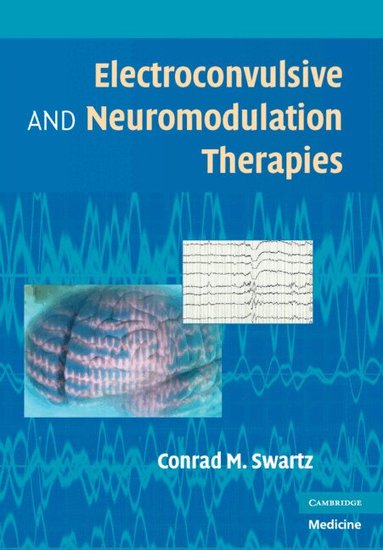 Conrad M. Swartz - Electroconvulsive and Neuromodulation Therapies, Inbunden