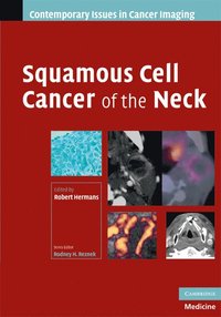 bokomslag Squamous Cell Cancer of the Neck