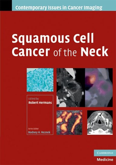 Robert Hermans - Squamous Cell Cancer of the Neck, Inbunden