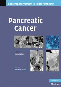 bokomslag Pancreatic Cancer