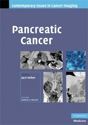 Jay Heiken - Pancreatic Cancer, Inbunden