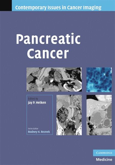 bokomslag Pancreatic Cancer