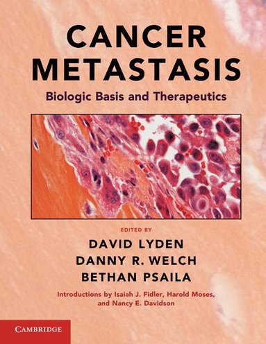 bokomslag Cancer Metastasis