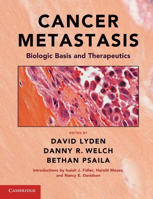 Cancer Metastasis 1