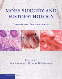 bokomslag Mohs Surgery and Histopathology