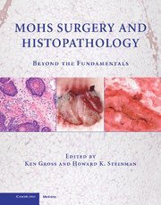 bokomslag Mohs Surgery and Histopathology