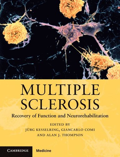 bokomslag Multiple Sclerosis