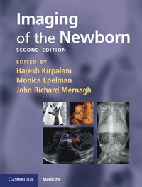 bokomslag Imaging of the Newborn