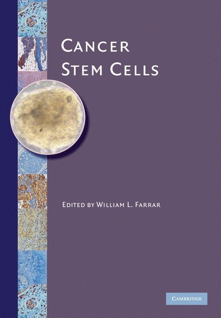 Cancer Stem Cells 1