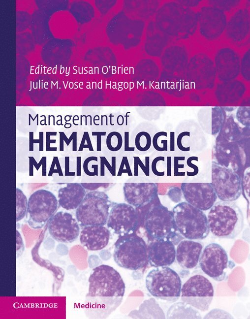 Management of Hematologic Malignancies 1