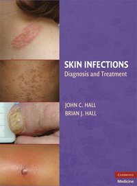 bokomslag Skin Infections