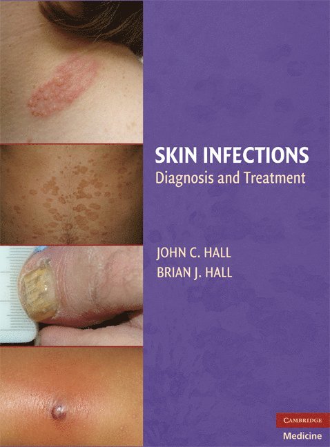 Skin Infections 1