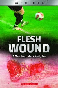 bokomslag Flesh Wound: A Minor Injury Takes a Deadly Turn (Xbooks)