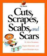 Alvin Silverstein, Virginia Silverstein - Cuts, Scrapes, Scabs, and Scars, Häftad