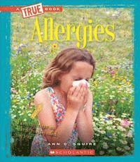 bokomslag Allergies