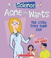 bokomslag The Science of Acne and Warts: The Itchy Truth about Skin (the Science of the Body)
