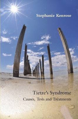 Tietze's Syndrome: Causes, Tests and Treatments