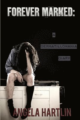 FOREVER MARKED: A Dermatillomania Diary 1