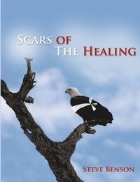 bokomslag Scars of the Healing