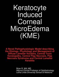 bokomslag Keratocyte Induced Corneal MicroEdema