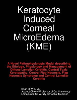 Keratocyte Induced Corneal MicroEdema 1