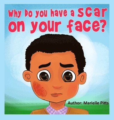 Why do you have a scar on your face? 1