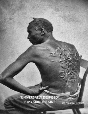 "Universally Despised" Is My Skin the Sin?
