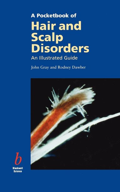 Gray, John Gray, Rodney Dawber - Pocketbook of Hair and Scalp Disorders, Häftad
