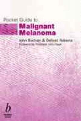 bokomslag Pocket Guide to Malignant Melanoma