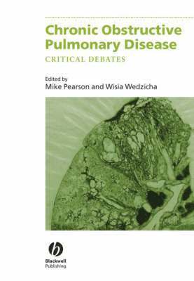 Michael Pearson, Jadwiga Wedzicha - Chronic Obstructive Pulmonary Disease, Inbunden