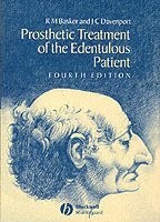 Prosthetic treatment of the edentulous patient