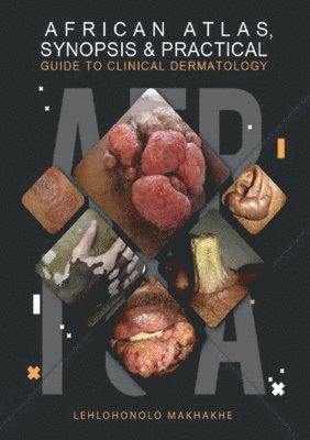 bokomslag African Atlas, Synopsis & Practical Guide to Clinical Dermatology