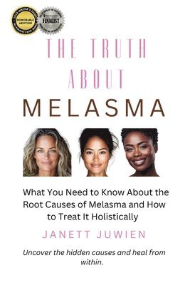 bokomslag Truth About Melasma