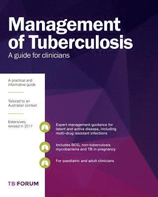 bokomslag Management of Tuberculosis