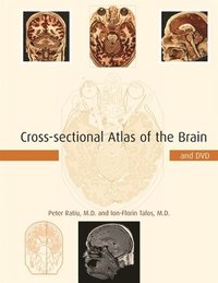 bokomslag Cross-sectional Atlas of the Brain and DVD