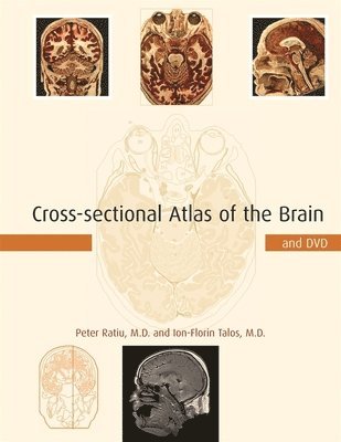 bokomslag Cross-sectional Atlas of the Brain and DVD