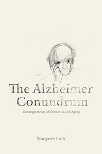 bokomslag The Alzheimer Conundrum