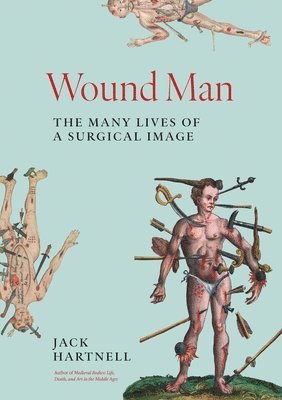 bokomslag Wound Man