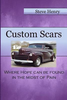 bokomslag Custom Scars: Where Hope Can Be Found in the Midst of Pain