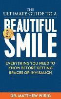 Matthew R. Wirig - The Ultimate Guide to a Beautiful Smile: Everything you need to know before getting braces or Invisalign!, Häftad