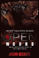 bokomslag Open Wound 1