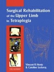 Surgical Rehabilitation of the Upper Limb in Tetraplegia