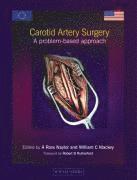 Carotid Artery Surgery