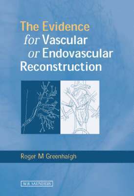 bokomslag Evidence for Vascular or Endovascular Reconstruction