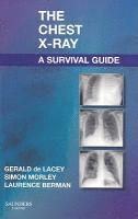 bokomslag The Chest X-Ray: A Survival Guide