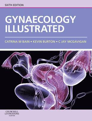 bokomslag Gynaecology Illustrated