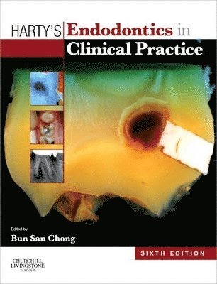 Harty's Endodontics in Clinical Practice 1